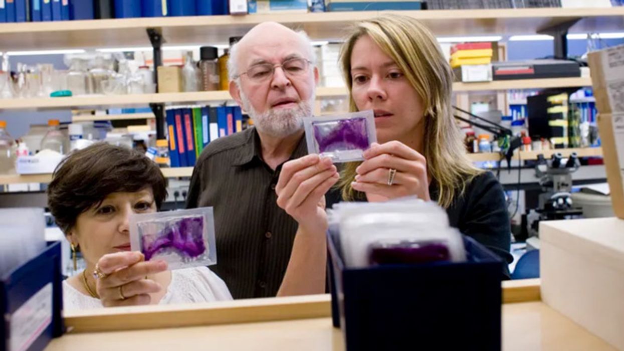 Researchers looking at BPA samples