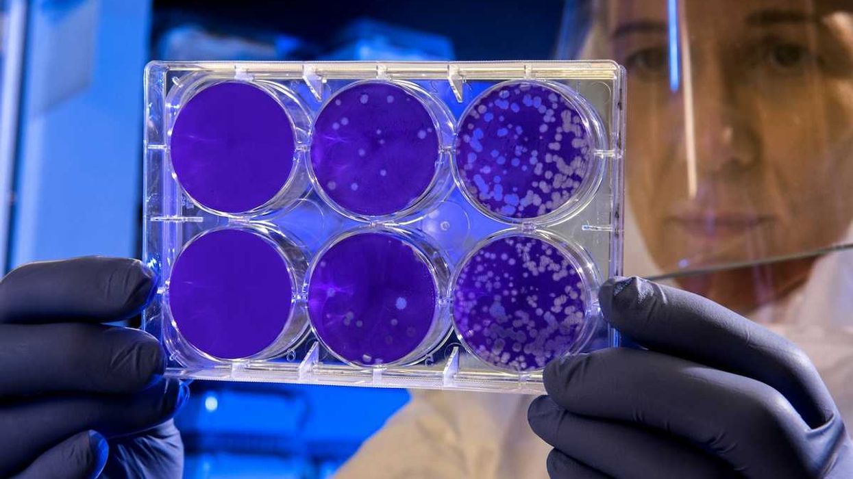 Scientist examines the result of a plaque assay, which is a test that allows scientists to count how many flu virus particles (virions) are in a mixture.