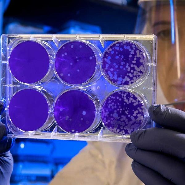 Scientist examines the result of a plaque assay, which is a test that allows scientists to count how many flu virus particles (virions) are in a mixture.