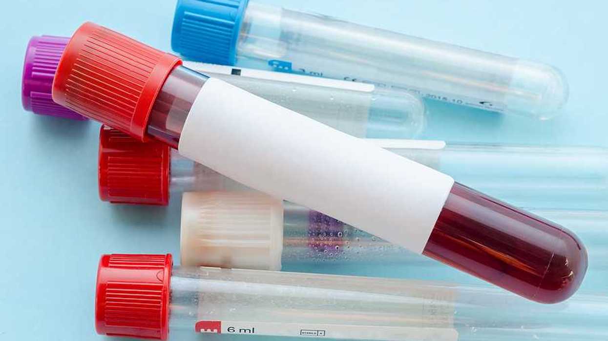 Several vials on a blue background, one with blood in it