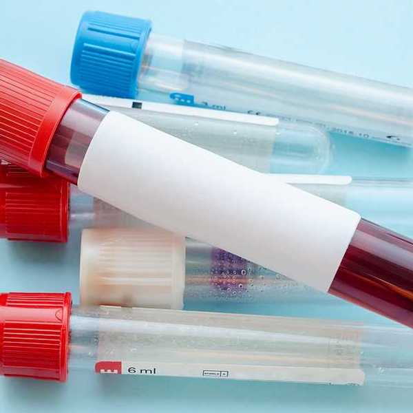 Several vials on a blue background, one with blood in it