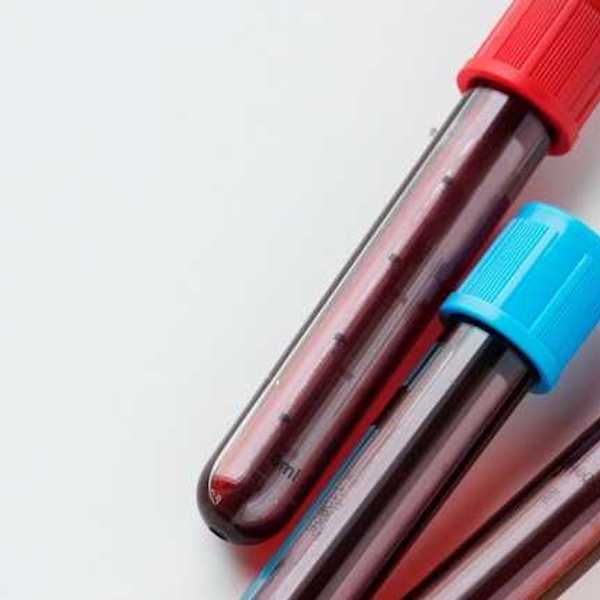 Three small vials of blood two with red caps and one with a blue cap