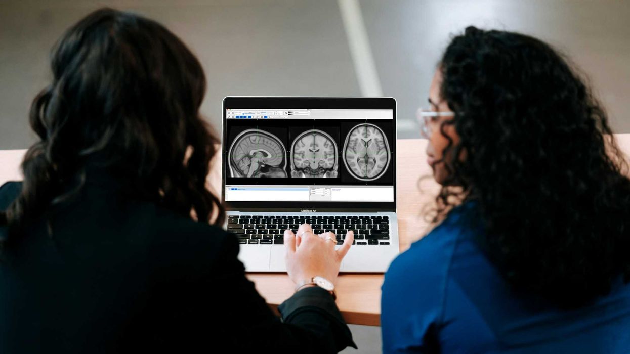 Two women looking at a computer screen with mri brain images on it