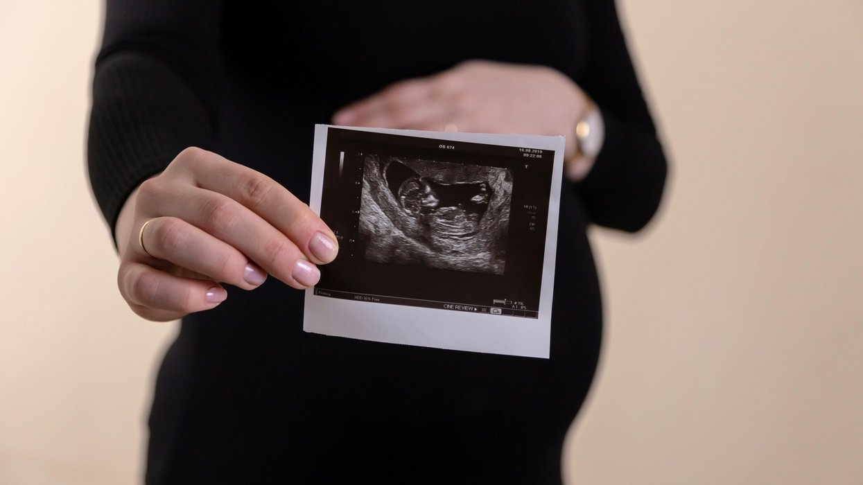 woman holding a picture of an ultrasound