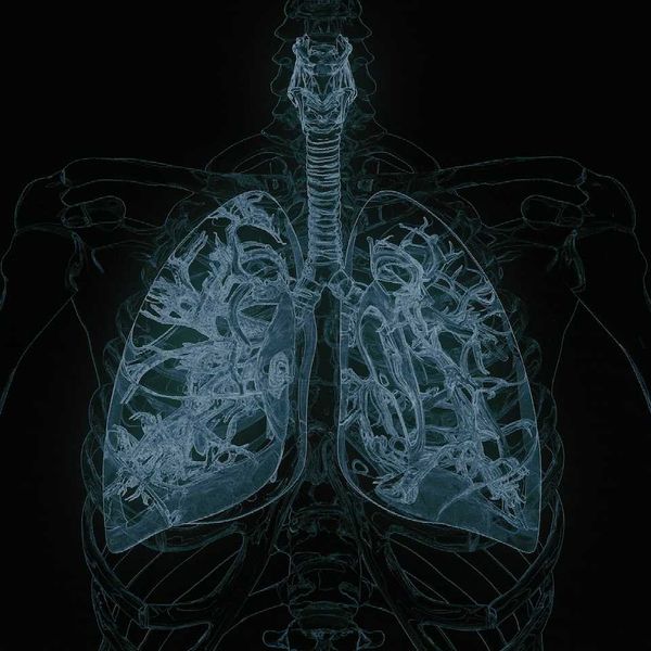 Xray with detailed view of lungs